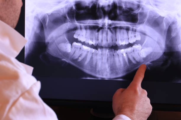 Best Emergency Tooth Extraction in Anahola, HI
